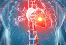 Ako imate aritmiju ovih 7 stvari morate da znate: Zašto se javlja i kako se leči?