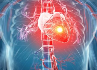 Ako imate aritmiju ovih 7 stvari morate da znate: Zašto se javlja i kako se leči?