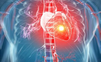 Ako imate aritmiju ovih 7 stvari morate da znate: Zašto se javlja i kako se leči?