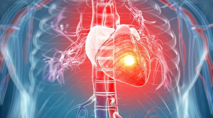 Ako imate aritmiju ovih 7 stvari morate da znate: Zašto se javlja i kako se leči?