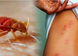 Ovo su znakovi da u kući imate stjenice: EVO KAKO DA IH SE MOMENTALNO RIJEŠITE