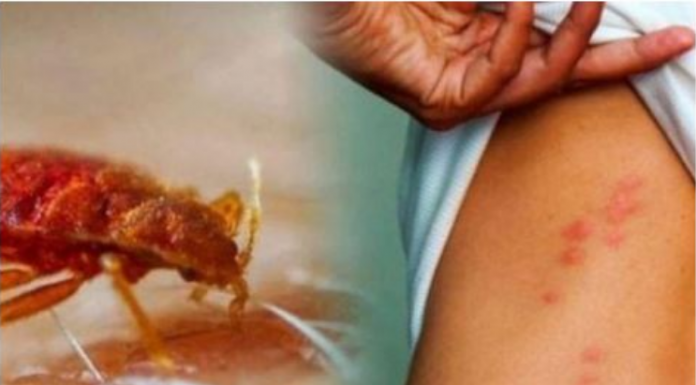 Ovo su znakovi da u kući imate stjenice: EVO KAKO DA IH SE MOMENTALNO RIJEŠITE