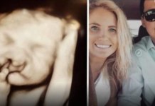 Doktori su mi rekli “abortus” kad su vidjeli bebin ultrazvuk: Nismo ih poslušali Moj sin danas ima 6 godina i izgleda ovako