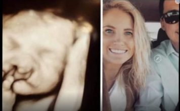 Doktori su mi rekli “abortus” kad su vidjeli bebin ultrazvuk: Nismo ih poslušali Moj sin danas ima 6 godina i izgleda ovako