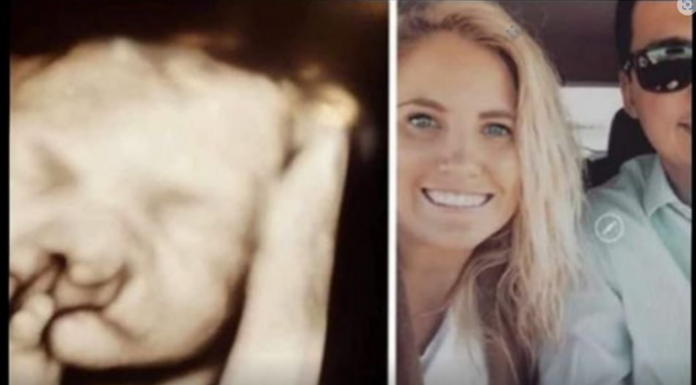 Doktori su mi rekli “abortus” kad su vidjeli bebin ultrazvuk: Nismo ih poslušali Moj sin danas ima 6 godina i izgleda ovako