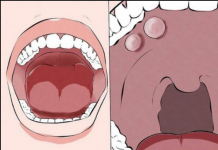 3 RAZLOGA ZAŠTO VAM SMRDI IZ USTA: Pranje zuba neće pomoći ako ovo ne riješite, EVO ŠTA JE U PITANJU