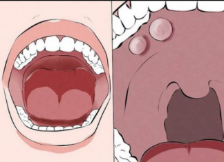 3 RAZLOGA ZAŠTO VAM SMRDI IZ USTA: Pranje zuba neće pomoći ako ovo ne riješite, EVO ŠTA JE U PITANJU