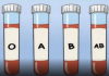 OVA KRVNA GRUPA JE NAJRIZIČNIJA ZA SRCE: Naučnici otkrili kod koga se krv zgrušava, A KOJA KRVNA GRUPA IMA POVIŠEN PRITISAK