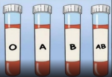 OVA KRVNA GRUPA JE NAJRIZIČNIJA ZA SRCE: Naučnici otkrili kod koga se krv zgrušava, A KOJA KRVNA GRUPA IMA POVIŠEN PRITISAK