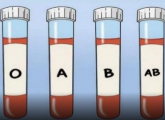 OVA KRVNA GRUPA JE NAJRIZIČNIJA ZA SRCE: Naučnici otkrili kod koga se krv zgrušava, A KOJA KRVNA GRUPA IMA POVIŠEN PRITISAK