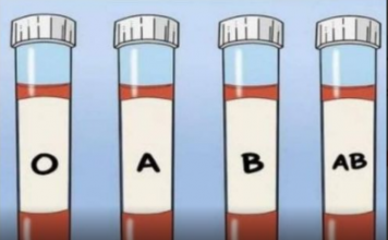 OVA KRVNA GRUPA JE NAJRIZIČNIJA ZA SRCE: Naučnici otkrili kod koga se krv zgrušava, A KOJA KRVNA GRUPA IMA POVIŠEN PRITISAK