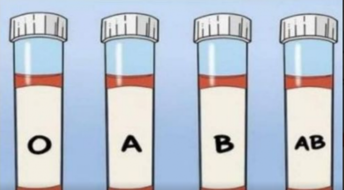 OVA KRVNA GRUPA JE NAJRIZIČNIJA ZA SRCE: Naučnici otkrili kod koga se krv zgrušava, A KOJA KRVNA GRUPA IMA POVIŠEN PRITISAK