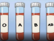 OVA KRVNA GRUPA JE NAJRIZIČNIJA ZA SRCE: Naučnici otkrili kod koga se krv zgrušava, A KOJA KRVNA GRUPA IMA POVIŠEN PRITISAK
