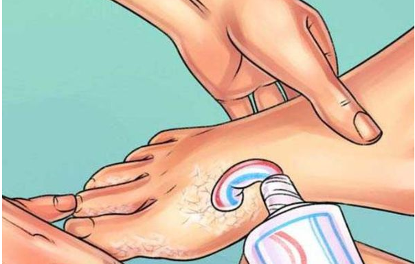 STAVILA JE PASTU ZA ZUBE NA STOPALA: Kada vidite razlog i vi ćete odmah URADITI ISTO!