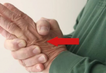 „Trnci u rukama“ često su PRVI SIMPTOMI ozbiljnih zdravstvenih problema. Koji su oni?