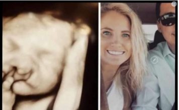 Doktori su mi rekli “abortus” kad su vidjeli bebin ultrazvuk: Nismo ih poslušali Moj sin danas ima 6 godina i izgleda ovako