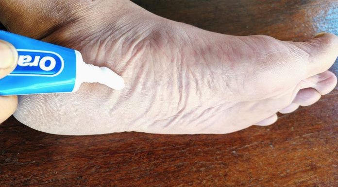 Samo stavite PASTU za zube na NOGE i više ne morate da trošite novac na pijaci!