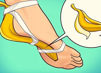 Svako veče stavljala je koru od banane na stopala: Rezultati su bili ZAPANJUJUĆI!