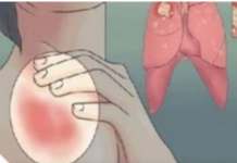 EVO KAKO MOŽETE PROVJERITI DA LI IMATE SLAB IMUNITET: 6 Znakova Lošeg Imuniteta, Ovako Tijelo Upozorava