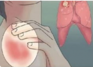 EVO KAKO MOŽETE PROVJERITI DA LI IMATE SLAB IMUNITET: 6 Znakova Lošeg Imuniteta, Ovako Tijelo Upozorava