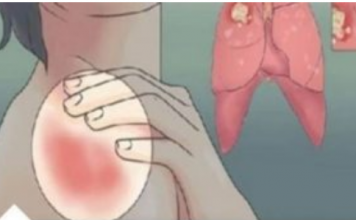 EVO KAKO MOŽETE PROVJERITI DA LI IMATE SLAB IMUNITET: 6 Znakova Lošeg Imuniteta, Ovako Tijelo Upozorava