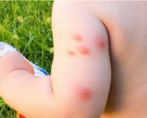 KOMARCI VAM PRAVE PAKAO OD ŽIVOTA? Samo isijecite OVO VOĆE na pola i ostavite u sobi, VIŠE IH NIKADA NEĆETE VIDJETI BLIZU!