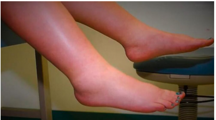 NUTRICIONISTA OTKRIVA ŠTA DA RADITE AKO VAŠE TIJELO ZADRŽAVA VODU: Sve što vam treba imate u kuhinji samo uzmite i…