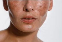 SODA BIKARBONA uklanja staračke mrlje: Ovo morate napraviti