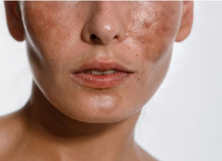 SODA BIKARBONA uklanja staračke mrlje: Ovo morate napraviti