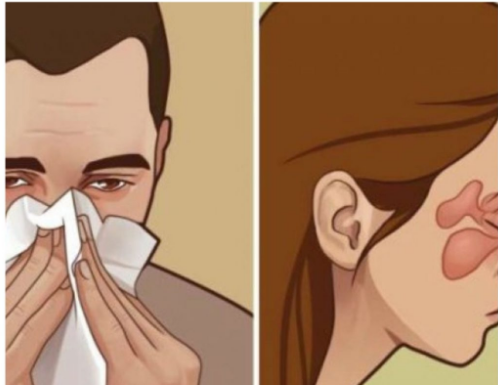 Budite se zapušenog nosa, a nije prehlada niti alergija? EVO ŠTA JE PROBLEM