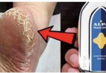 Potrebno je samo nekoliko dana, a noge su vam kao beba: Više se ne borim sa otvrdnulom kožom i modricama na nogama, OVO RADI BILO LJETO ILI ZIMA!