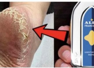 Potrebno je samo nekoliko dana, a noge su vam kao beba: Više se ne borim sa otvrdnulom kožom i modricama na nogama, OVO RADI BILO LJETO ILI ZIMA!