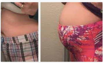 Evo kako da se brzo oslobodite bolova i gasova – AKO VAM JE ČESTO NADUT STOMAK, OVO MORATE URADITI!