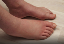 Ključni VITAMIN za uklanjanje OTEKLINA NOGU, NOŽNIH ZGLOBOVA I STOPALA!