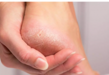 Rastopite u posudi sa toplom vodom i potopite stopala: BIĆE GLATKE I MEKANE KAO IZ SALONA!