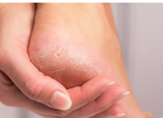 Rastopite u posudi sa toplom vodom i potopite stopala: BIĆE GLATKE I MEKANE KAO IZ SALONA!