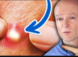 Doktor upozorava: Ovo je 10 JASNIH znakova da jedete previše šećera. Malo ko će ih primijetiti!