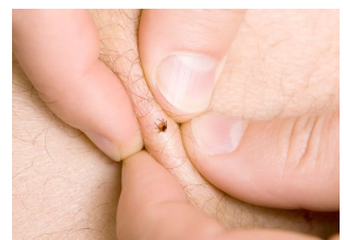 KAKO UKLONITI KRPELJA POMOĆU OBIČNE SOLI: Poslije ovog, krpelj odmah sam izađe na površinu kože!