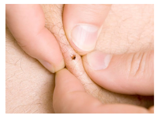 KAKO UKLONITI KRPELJA POMOĆU OBIČNE SOLI: Poslije ovog, krpelj odmah sam izađe na površinu kože!