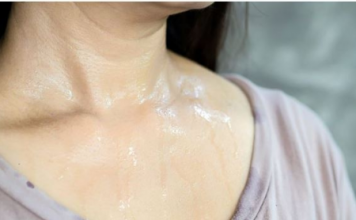 Mesta na kojima se znojite otkrivaju kakvog ste zdravlja: Evo kada se treba odmah javiti lekaru…FOTO