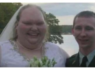 Bila je najružnija mlada ikada, a njena transformacija je sve ostavila bez teksta: Njena lepota danas oduzima dah