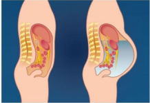 OVO POVRĆE IZAZIVA NADIMANJE STOMAKA I GASOVE: Ovu hranu izbjegavajte ako želite ravan stomak