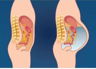 OVO POVRĆE IZAZIVA NADIMANJE STOMAKA I GASOVE: Ovu hranu izbjegavajte ako želite ravan stomak