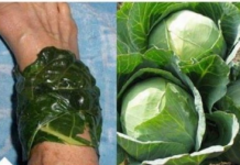 U ŠVICARSKOJ SE KORISTI KAO LIJEK: Evo šta obloga od lista kupusa čini za vaše zdravlje