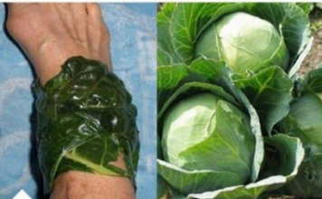 U ŠVICARSKOJ SE KORISTI KAO LIJEK: Evo šta obloga od lista kupusa čini za vaše zdravlje