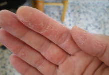 Signali Vašeg Tijela: Šta Znače Promjene na Koži i Kosi?