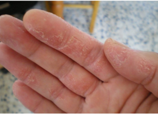 Signali Vašeg Tijela: Šta Znače Promjene na Koži i Kosi?