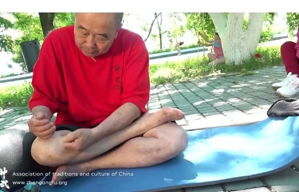 Stari kineski TRIK da se riješite bolova u koljenu bez tableta: Isprobano, djeluje!