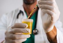 Na šta ukazuju povišeni leukociti u urinu: Evo koliko može biti opasno i šta treba preduzeti