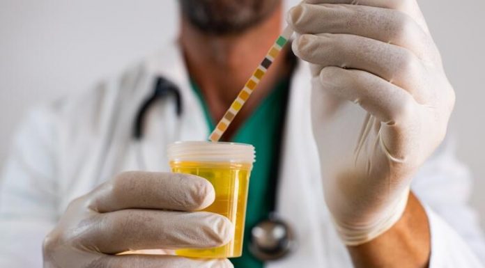 Na šta ukazuju povišeni leukociti u urinu: Evo koliko može biti opasno i šta treba preduzeti